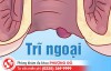 Bệnh trĩ ngoại: Nguyên nhân, dấu hiệu nhận biết và phương pháp cắt trĩ không đau